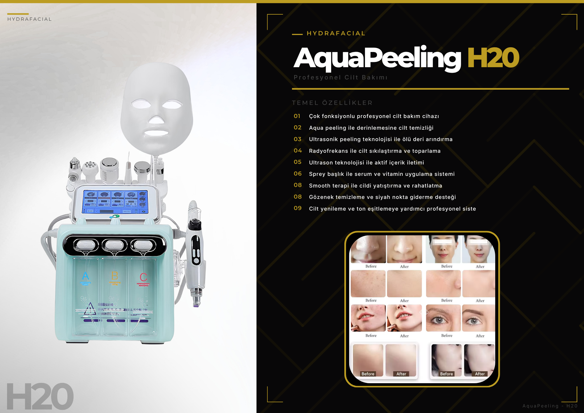 AquaPeeling H20